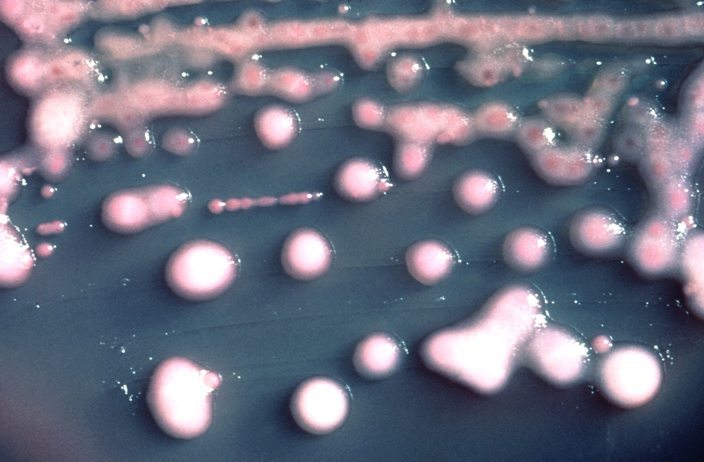 Growth on MacConkey agar