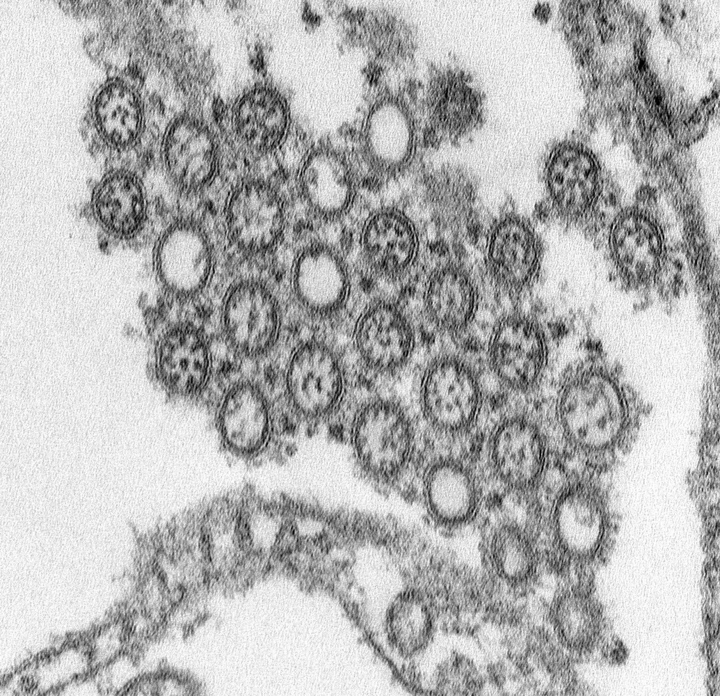 Influenza A: transmission electron microscopy